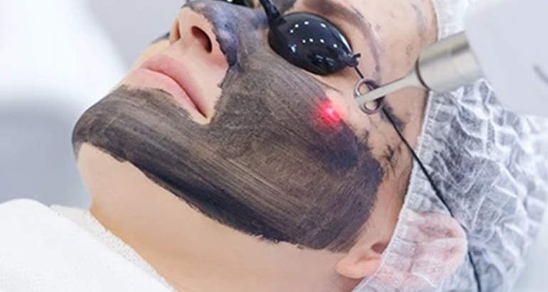 Hollywood Facial (Carbon Laser facial)