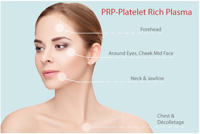 Face PRP (Platelete Rich Plasma)